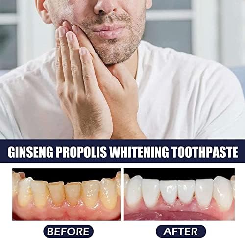 Zubna pasta za očuvanje propolisa ginsenga, zubna pasta za njegu oslabljenih zuba, dubinska pasta za čišćenje zuba, izbjeljivanje zuba,